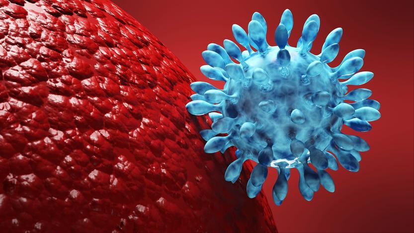 艾滋病早期皮疹表现_艾滋病与水痘_艾滋病皮肤症状