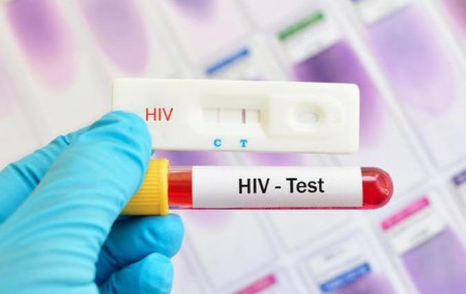 艾滋病早期症状_艾滋病皮肤表现_艾滋病与水痘