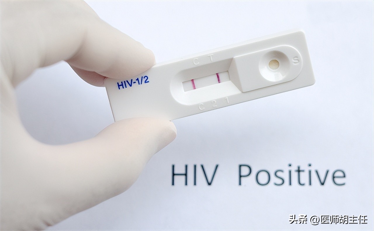 艾滋病皮肤病变_艾滋病与水痘_艾滋病早期症状