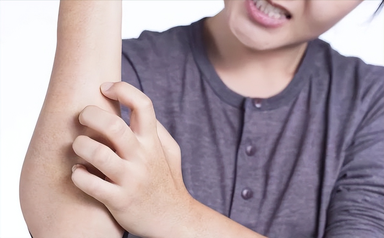 HIV皮疹特征_艾滋病早期皮肤症状_艾滋病与水痘