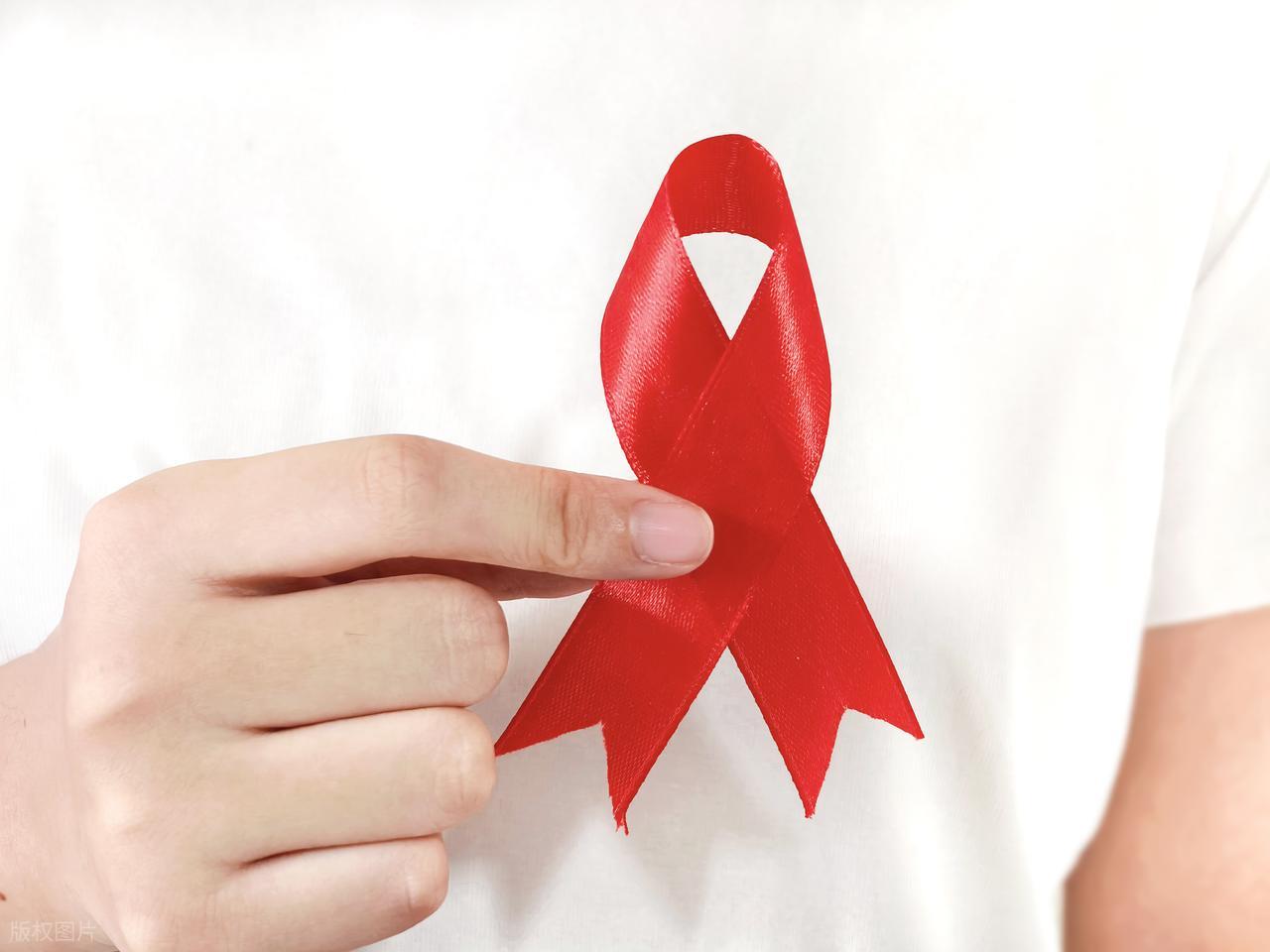 HIV感染早期皮肤症状_艾滋病与水痘_艾滋病女性手臂皮肤异常