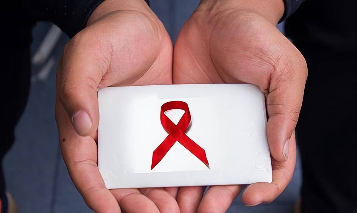 艾滋病皮肤症状_艾滋病与水痘_带状疱疹与艾滋病