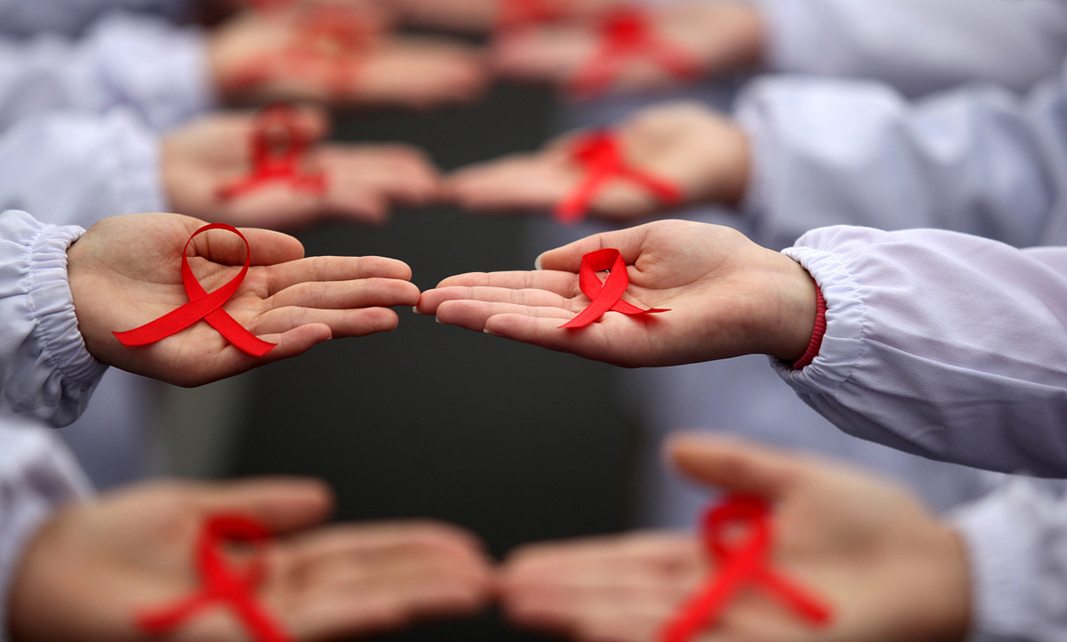 艾滋病皮肤症状_带状疱疹与艾滋病_艾滋病与水痘