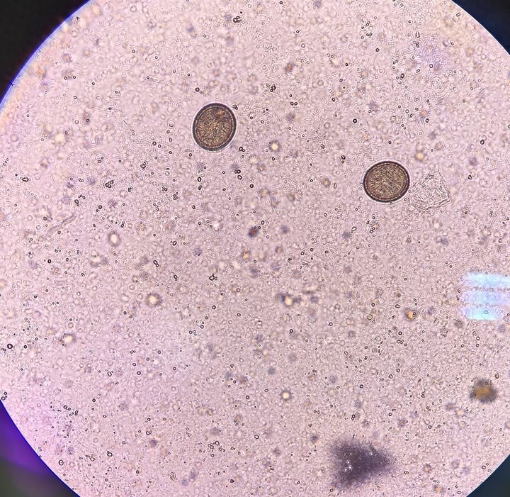 kiayun手机版登录.v1008.点进白给你1888.中国 吓坏了！小伙体内藏2.73米长的虫