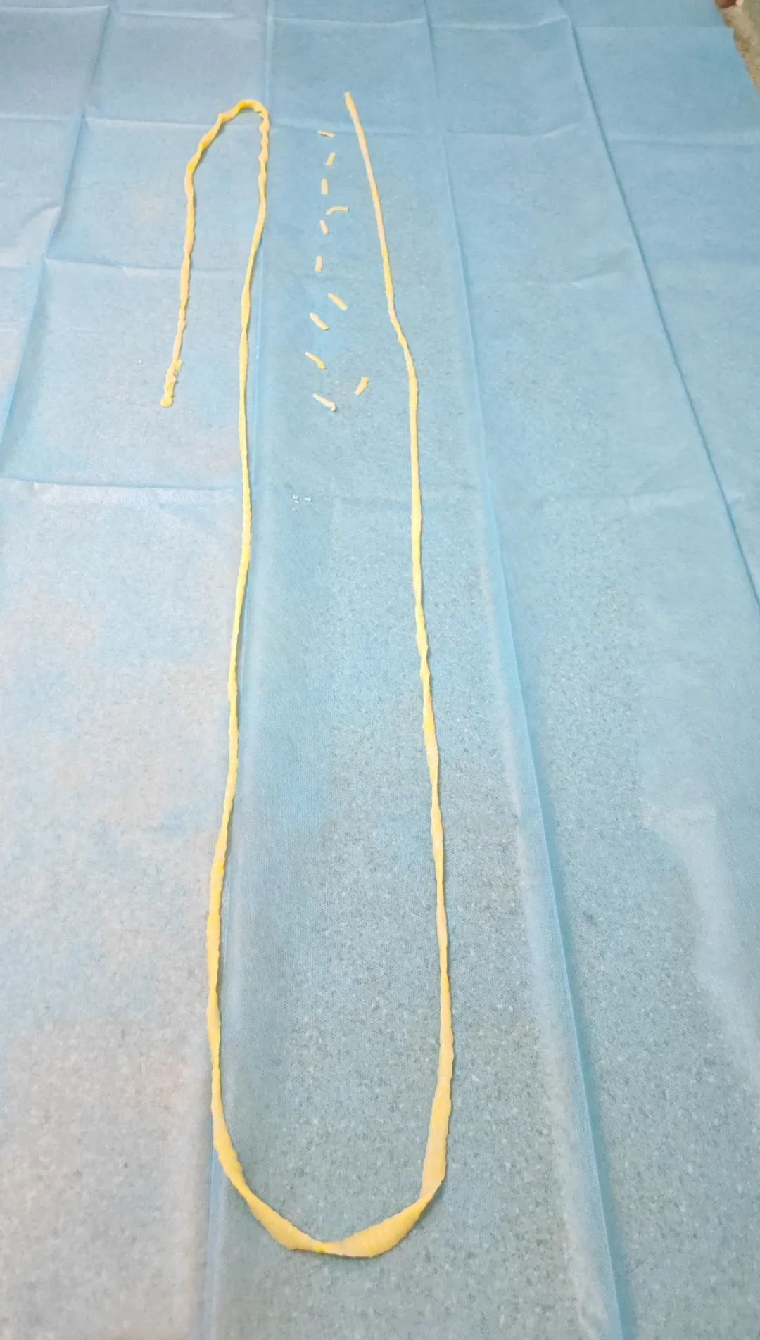 生鱼片寄生虫感染_牛带绦虫虫卵_牛带绦虫症状