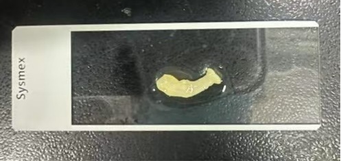 牛带绦虫症状_生鱼片寄生虫感染_牛带绦虫虫卵