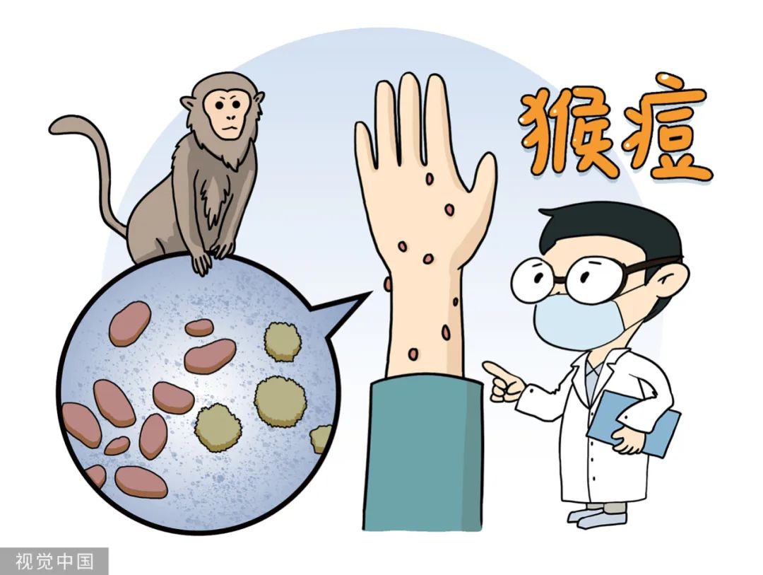猴痘、天花、牛痘、水痘怎么应对?
