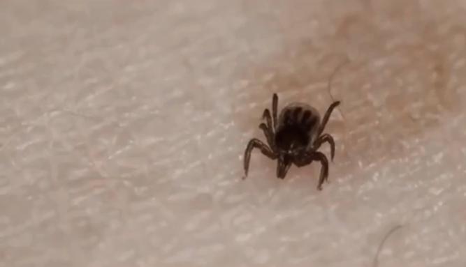 脾虫咬后的伤口图_蜱虫叮咬 新型布尼亚病毒 马鞍山蜱虫叮咬